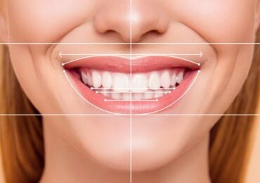 Cosmetic Smile Design